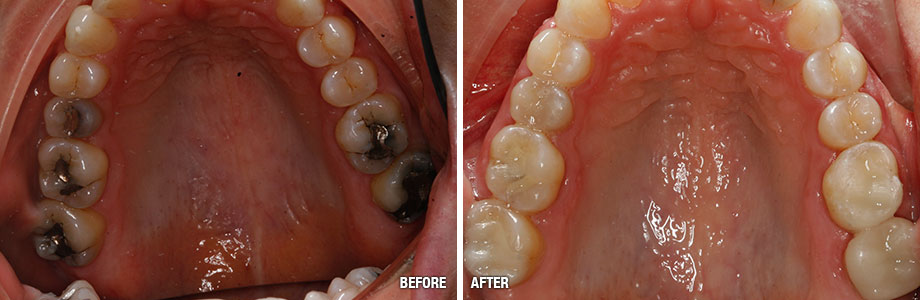 Before After Patient Image