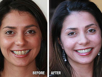 Before After Patient Image